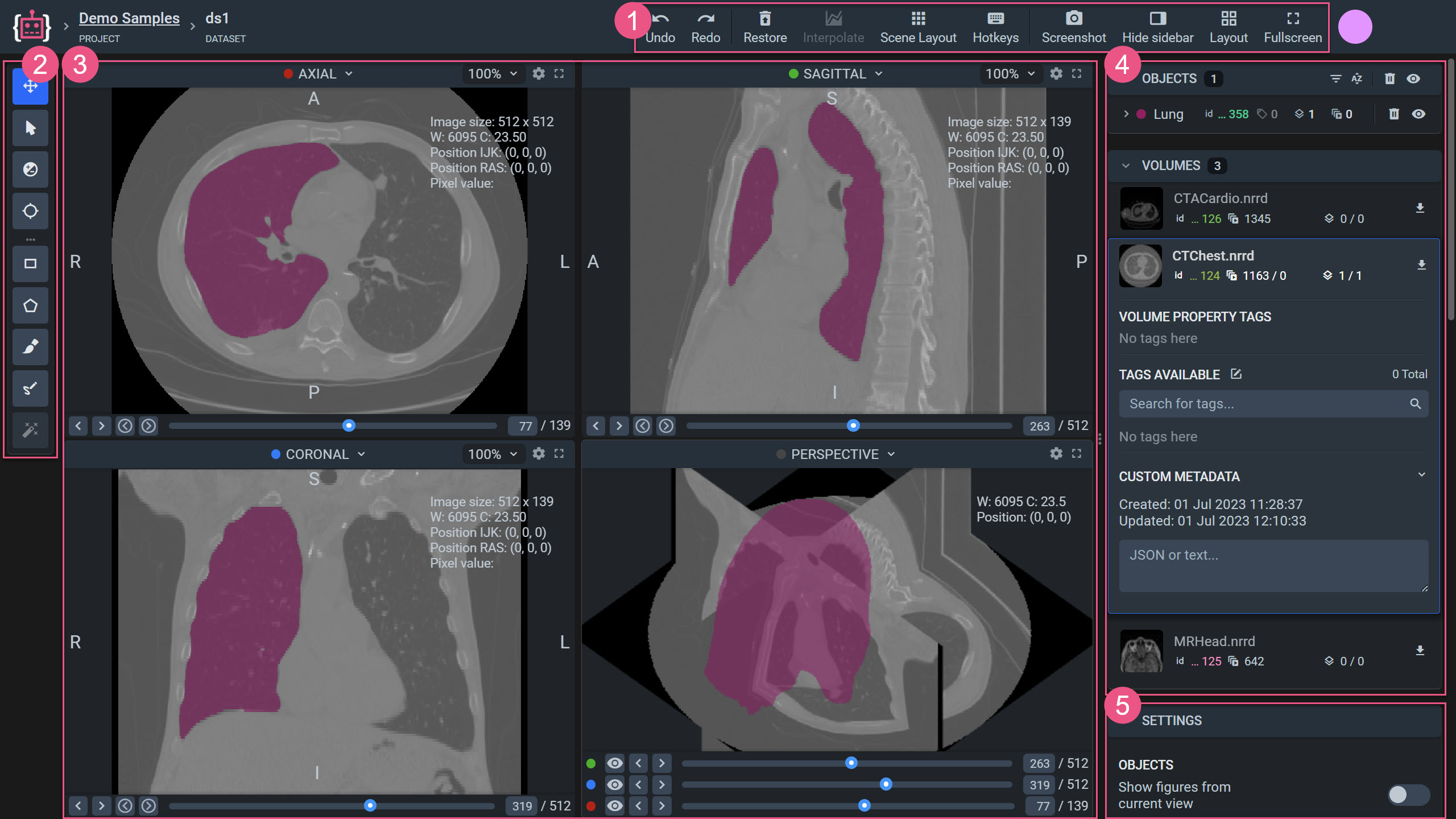 radiology image labeling AI medical annotation